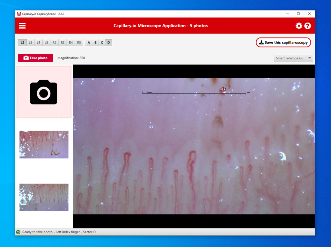 Aplicación CapillaryScope subiendo imágenes calibradas de capilaroscopia Dino-Lite a Capillary.io