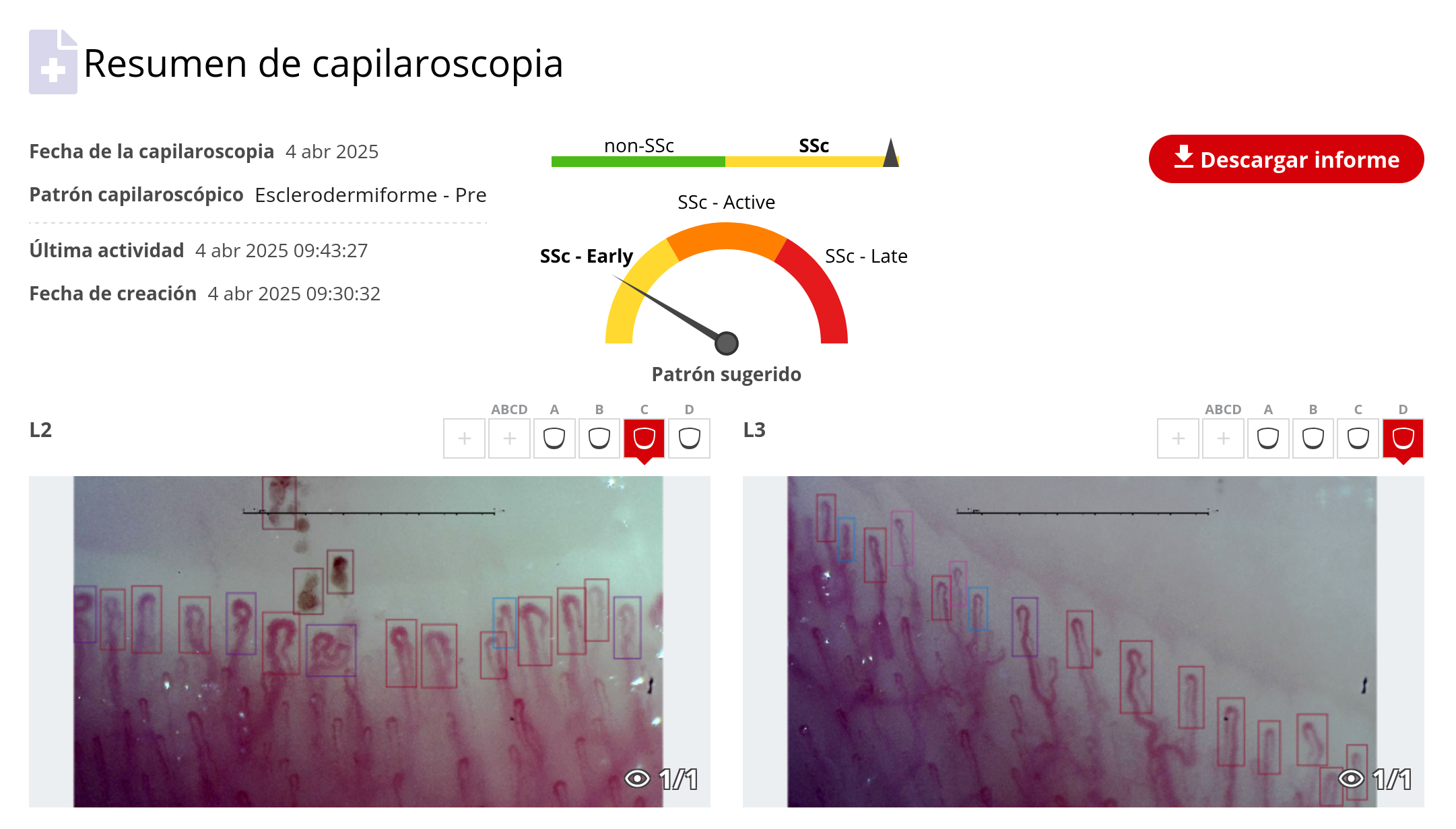Ejemplo de capilaroscopia en la aplicación web de Capillary.io