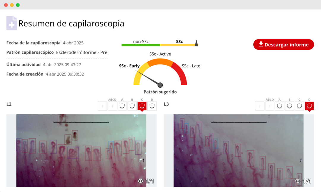 Captura de pantalla del software de capilaroscopia